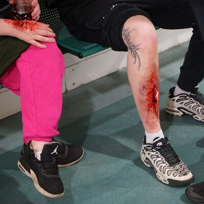 Zwei Personen sitzend im verunfalltem Zug und Ansicht der fiktiv erlittenen Verletzungen.